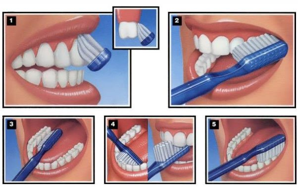 Should My Child Use An Electric Toothbrush Milk Tooth